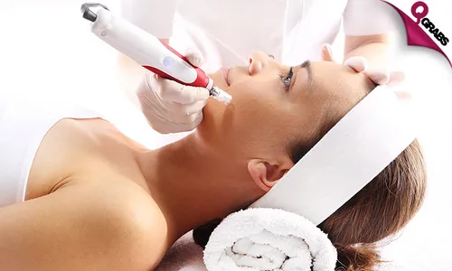 Dermapen Face Treatment!